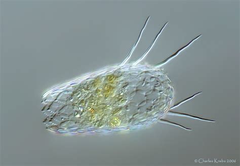  Ambiphrya!  An Unusual Amoeboid Champion that Can Glide and Shape-Shift 